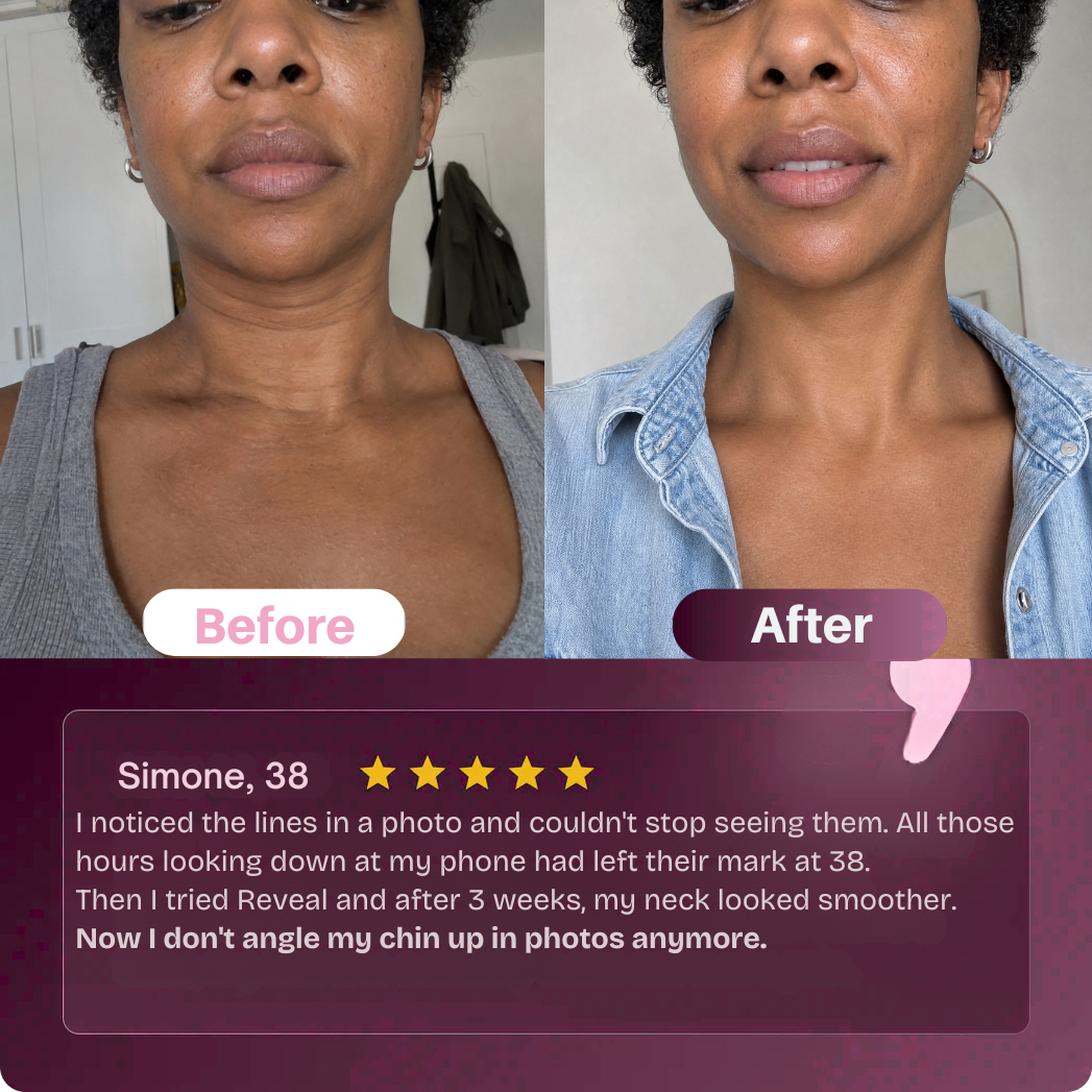 neck-lines