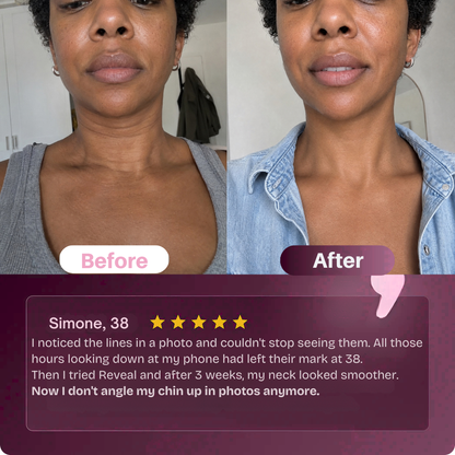 neck-lines